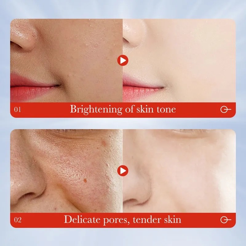 Mascarilla Dormir Ácido Kójico Blanquear
