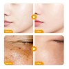 Esencia Facial 4 En 1 Que Elimina Manchas Y Humecta