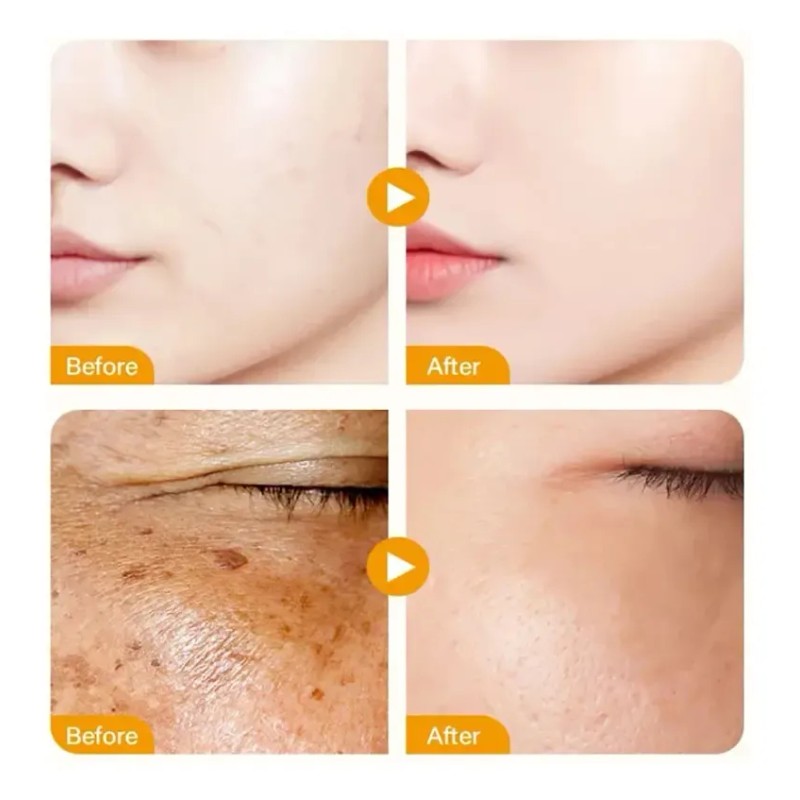 Esencia Facial 4 En 1 Que Elimina Manchas Y Humecta