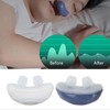 Electric Device to Prevent Snoring, Easy Breathing, Improve Sleep Quality,