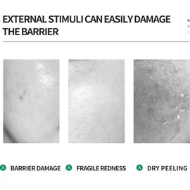 B5 Serum Anti-Wrinkle Serum, B5 Serum-Konzentrat, Aufhellendes Gesichtsserum, Anti Aging Serum Gesicht, Gesichtsserum für Reduziert Falten, Feuchtigkeitsserum für Frauen Essence Skin Care