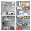 Skycase Fridge Organiser, Fridge Organiser Set, Transparent Fridge Storage Box,