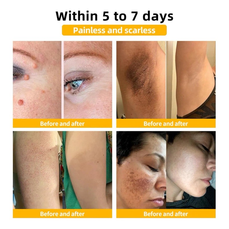 Esta Crema Suaviza La Piel, Atenúa Manchas E Jx