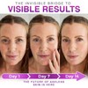 3/4PCS 3-in-1 Microdarts Anti-Aging Patch-(1.6"X 60" Roll-1.5M), 2026 New Professional