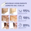 Crema para Cuello Reafirmante: Crema para Reducir los Pliegues del