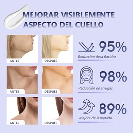 Crema para Cuello Reafirmante: Crema para Reducir los Pliegues del Cuello (50ML)
