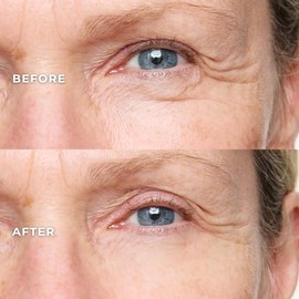 WUNDER2 WUNDERLIFT 60 Seconds Wrinkle Reducer - Eye Serum to Reduce Lines and Dark Circles, 0.40 Fl Oz