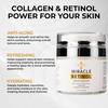 Miracle Retinol Moisturizer – 2.5% Active Retinol, Vitamin E &