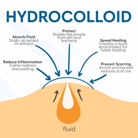 BLOOMORA BLOOMORA Invisible Pimple Patches (180 Count) - Hydrocolloid Acne Spot Treatment - Zit Patches for Face - Acne Treatment for Clear Skin - S/L Sizes