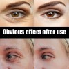 Crema Hidratante Para Ojos Con Caviar De Astaxantinazhy