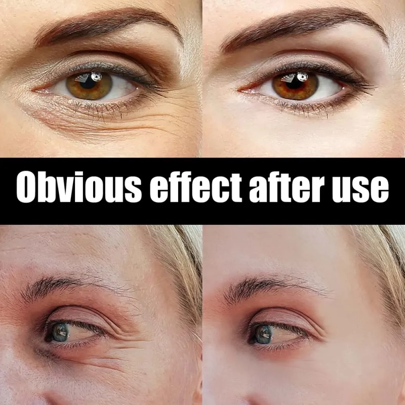 Crema Hidratante Para Ojos Con Caviar De Astaxantinazhy