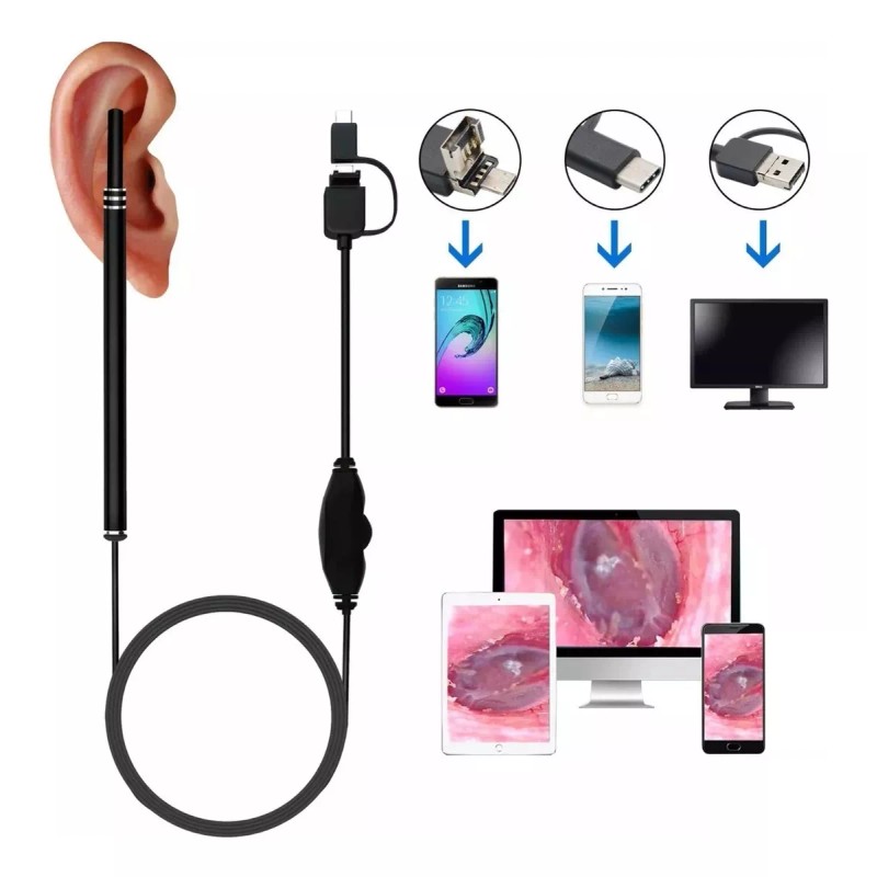 Dahua Cámara Endoscopio Wifi De Oídos, Otoscopio Con 6 Led's