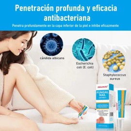 Crema De Uñas Antifúngico Para Uñas De Manos Y Pies 30g