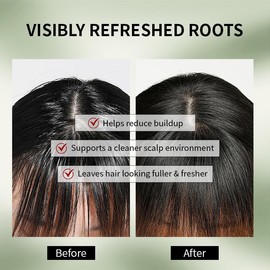 ALFHEIM Saw Palmetto Scalp Serum to Strengthen Follicles | With Caffeine & Biotin for Fuller Hair | Helps Balance Scalp, Revive Hair Roots & Enhance Hair Density | 0.34 fl oz + Serum Applicator