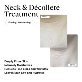 MATKAS Korean Retinol Neck Firming Cream - .38 Fl Oz - Skin Barrier Repair Moisturizer + Shea Butter, Korean Skin Care Neck Creams for Tightening and Firming, Lifting, Retinol for Anti Aging, Sagging