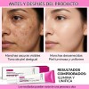 Crema Despigmentante, Hidratante E Iluminadora, 2 Unidades