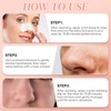 2Pcs Blackhead Remover Tools, Portable Blackhead Scraper, Nose Scraper for