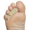 Steins Hammer Toe Crest Cushion and Buttress Pad Reduces Pressure