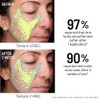 Advanced Microdermabrasion Face Exfoliator by Dr. Brandt for Unisex -