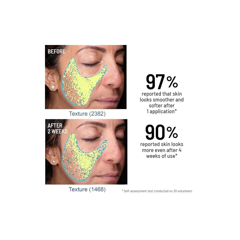 Advanced Microdermabrasion Face Exfoliator by Dr. Brandt for Unisex -