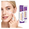 Suero Facial Con Ácido Azelaico 12% Niacinamida Y Vitamina C