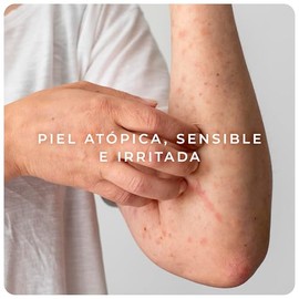 DERMAN Cuidados Intensivos Atopi Calm, Emulsión Corporal Dermatológica 400 mL para Piel Atópica, Sensibilidad e Irritación, Crema Corporal Hidratante 