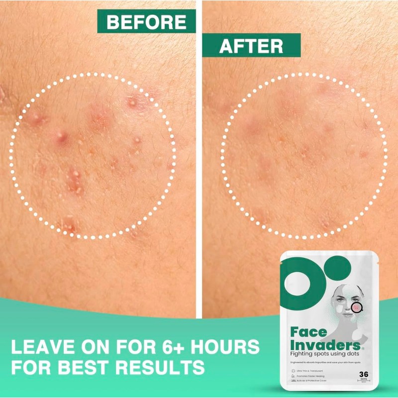 Face Invaders Acne Patches | Pack of 108 Translucent Hydrocolloid