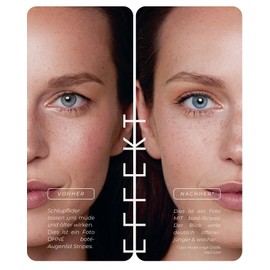 BOTÉ 144 Slip-On Eyelids Stripes Invisible & Breathable (L) - Eyelid Tightening Strips for Radiant Eyes - Eyelid Stickers Against Slip-on Eyelids - Slip-On Lid Stripes - Dermatest "Very Good" - New