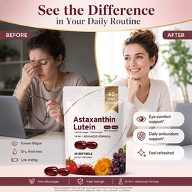 Astaxanthin Eye Support Capsules for Women – Vegan Daily Wellness Supplement for Eye, Skin & Joint Care