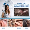 Scalp Cream for Psoriasis Folliculitis, Helps Relieve Itching Flaking, with