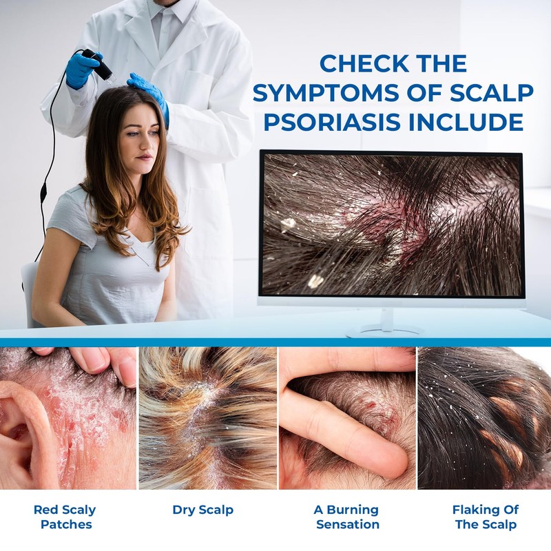 Scalp Cream for Psoriasis Folliculitis, Helps Relieve Itching Flaking, with