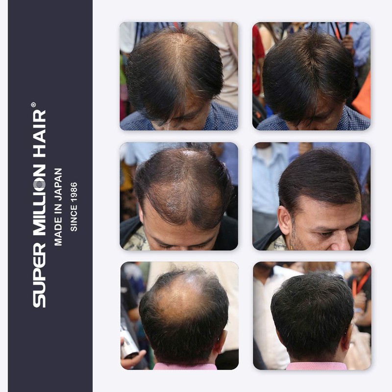 Super Million Hair - 1 x 15g Hair Building Fibres