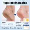 2PCS Crema Hidratante Para Pies con Urea 60