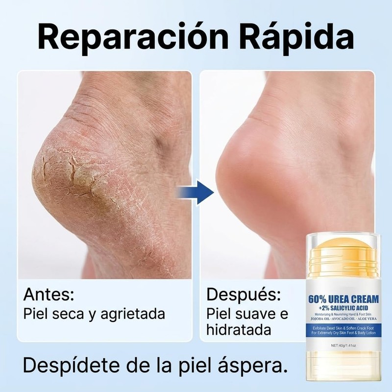 2PCS Crema Hidratante Para Pies con Urea 60