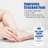 La Crema De Urea Y Protección For Manos Y Pies