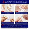 4Pcs Nail Care Pens, Moisturizing Nail Strengthener for Discoloured Nails