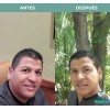 MARGARITA ABURTO Hieloterapia Facial Margarita Aburto