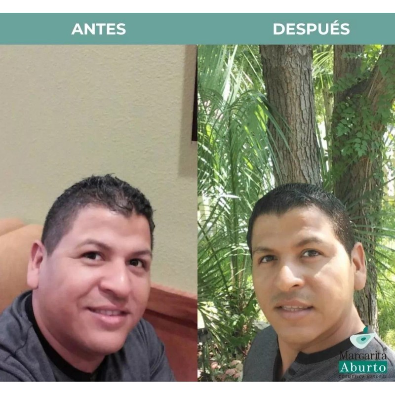 MARGARITA ABURTO Hieloterapia Facial Margarita Aburto