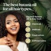 Keyoma Batana Oil for Hair Growth with Rosemary: Nourish &