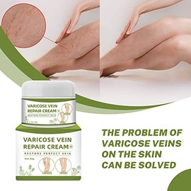 Crema de venas varicosas, crema reparadora de araas vasculares, tratamiento de venas varicosas para piernas (1.76 oz)                                 