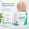 Crema Para Cicatrices Estrías Marcas Visibles Cuidado Piel
