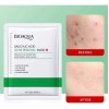 Mascarilla Acido Salicilico Pieles Con Acne Bioaqua 10pz