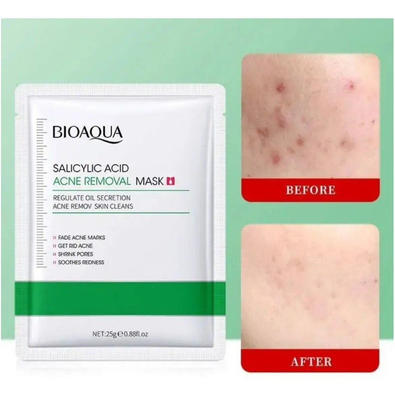 Mascarilla Acido Salicilico Pieles Con Acne Bioaqua 10pz