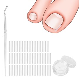zoerbufan Ingrown Toenail Correction Kit, 50 Pieces Painless Toenail Straightening Strips, Nail Filler for Correcting Toenail Ingrown with Toenail Lifter