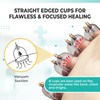 Vavacup [100 Pack] Bulk Hijama Cups for Cupping - B1