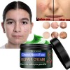 Eelhoe Crema Antiedad Para Rostro Cuello y Pecho Elimina Manchas