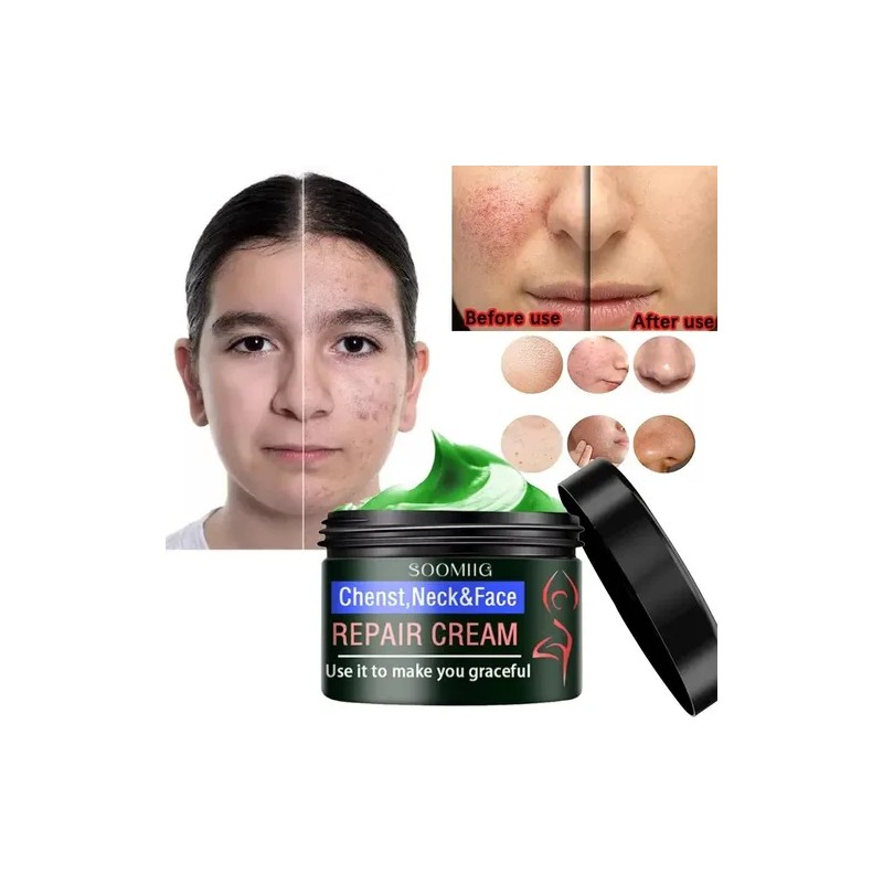 Eelhoe Crema Antiedad Para Rostro Cuello y Pecho Elimina Manchas
