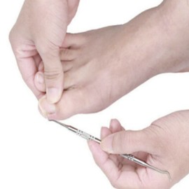Sungsujok Art Removal Self Nail Ingrown Curette Cuticle Toenail Dirt Nail