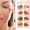 INSTANT EYEBAG REMOVER, DARK CIRCLES, FINE LINES, PUFFINESS, ANTI-WRINKLES