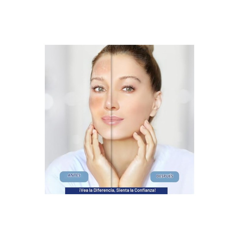 Eliminador Manchas Oscuras Mujeres Hombres Crema Correctora Mágica Todas Pieles